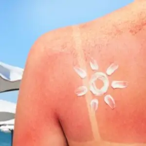 Protetores para o sol da Colômbia